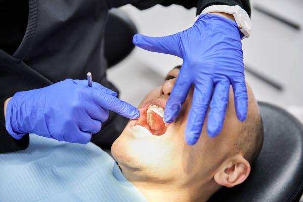 Best Emergency Dental Services for Seniors in Pierre, SD